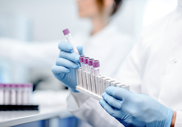 即日検査に対応