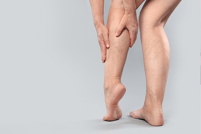 足のむくみ・歩行時の痛み