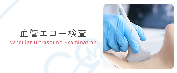 血管エコー検査